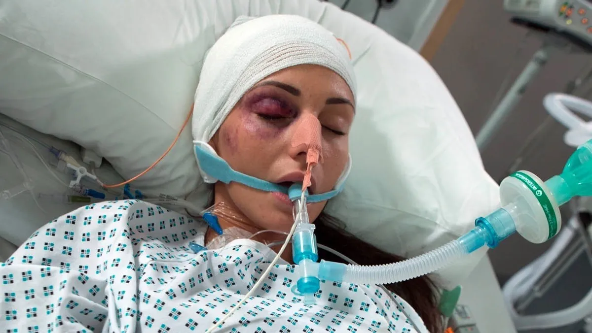 michelle keegan coronation street in coma