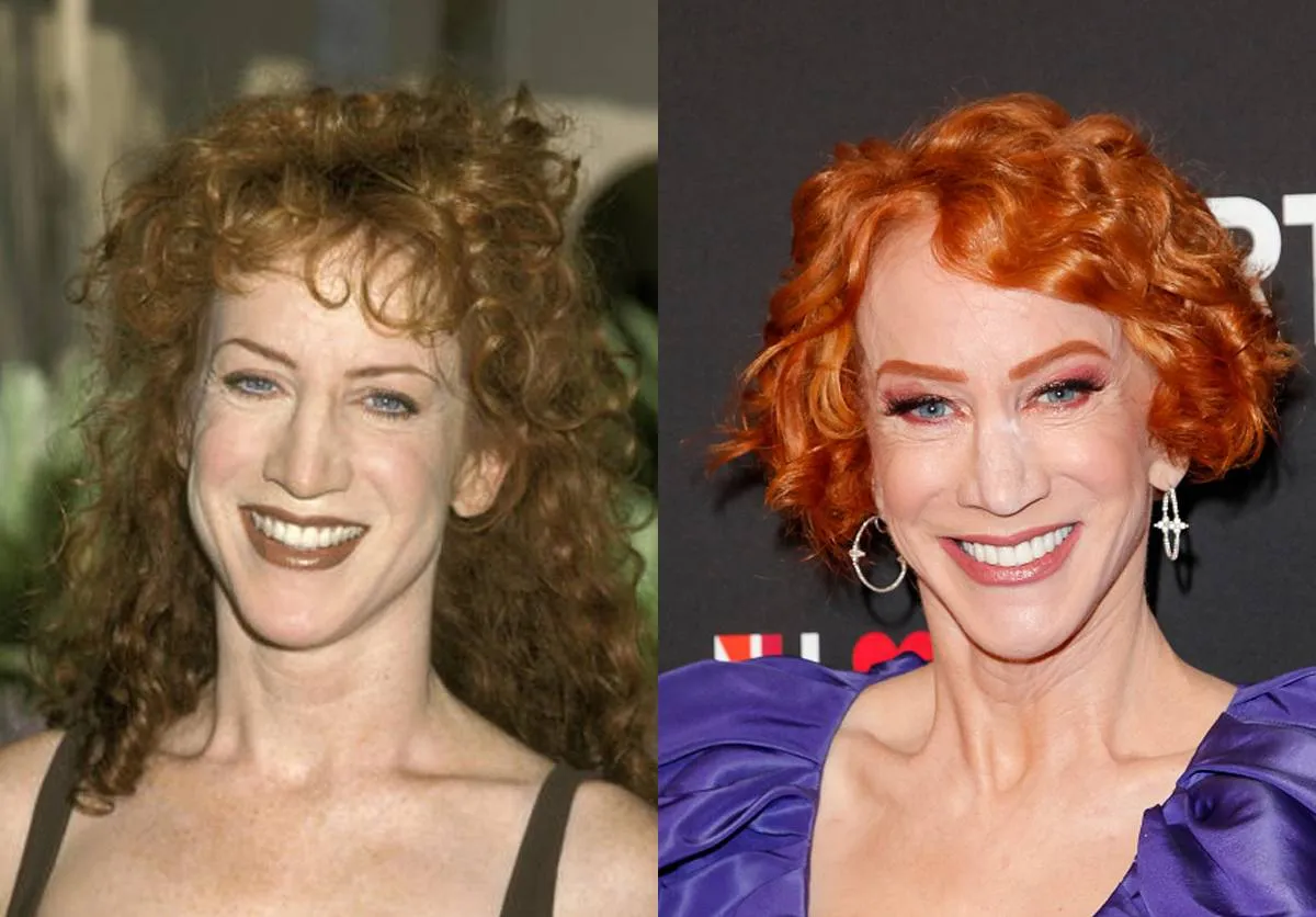 kathy-griffin-before-after-plastic-surgery