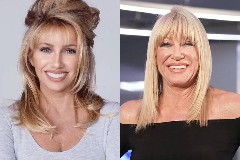 suzanne-somers-plastic-surgery