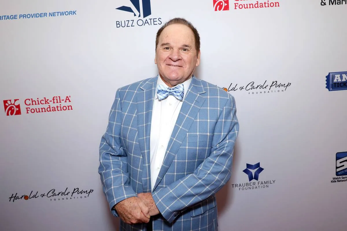 Pete Rose, Now The Master Of The Receding Hairline