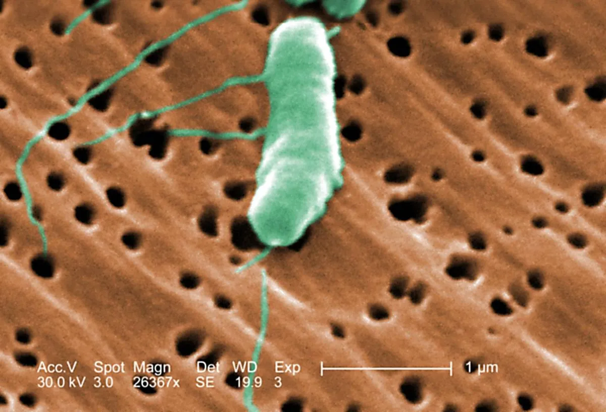 Microscopic bacteria is seen.