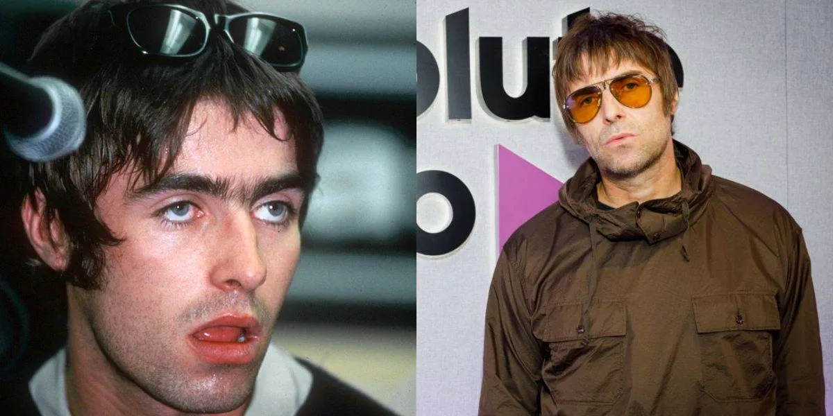 Liam Gallagher before and after